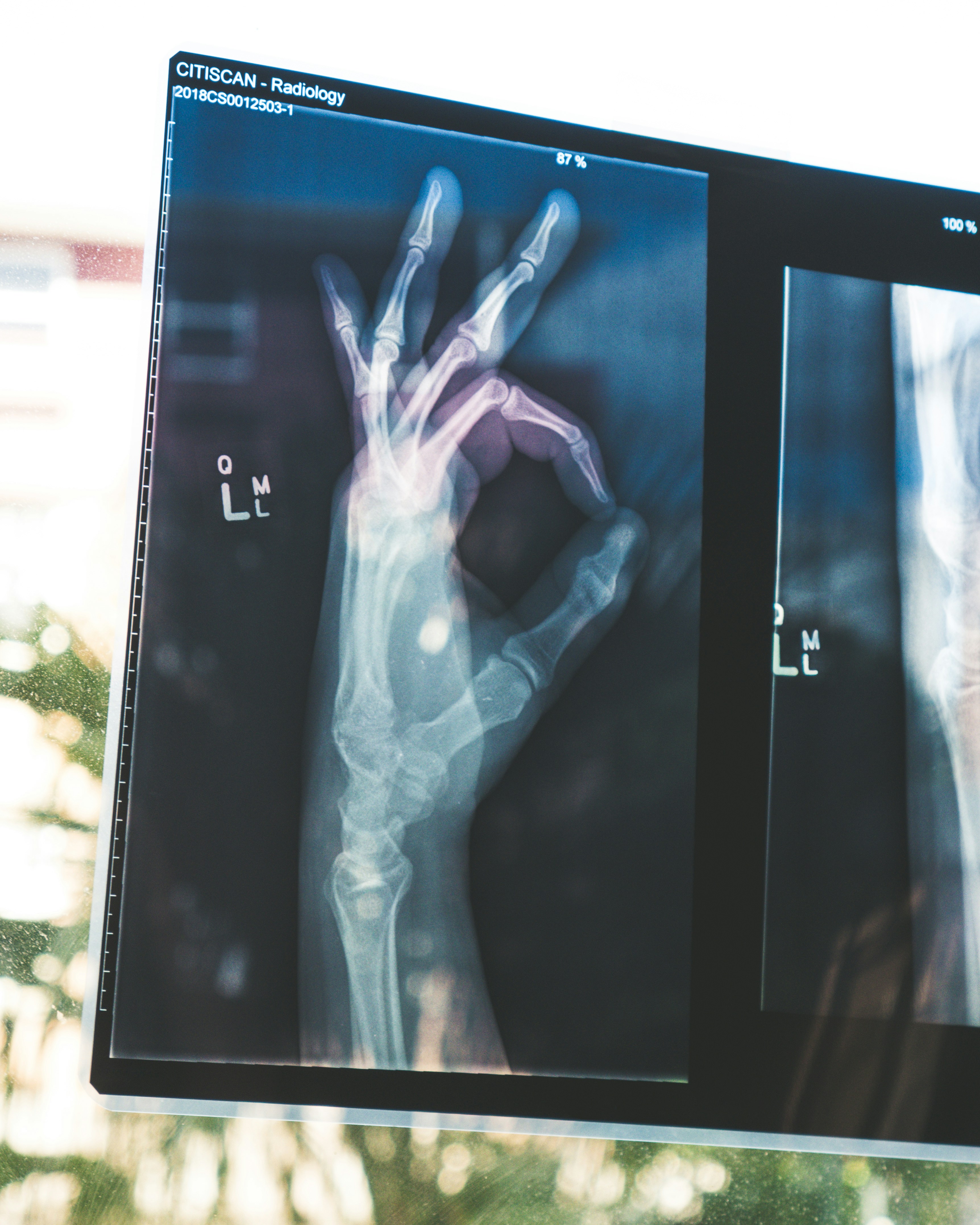 Medical IT Xray